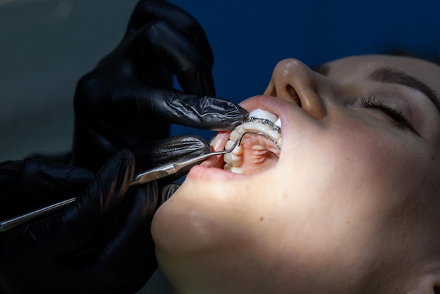 A woman at a dentist's appointment to replace arches with braces