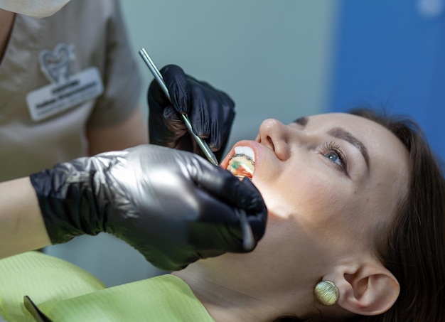 アーチを歯列矯正器具に置き換えるために歯科医の診察を受ける女性
