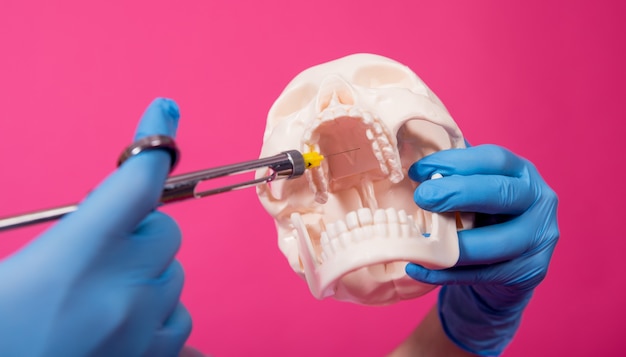 Woman dentist with a carpool syringe injects anesthetic into the gum of the artificial skull