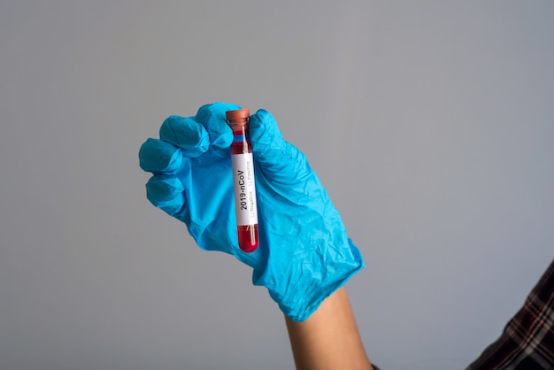 Woman Doctor holding a test tube with blood sample for coronavirus or 2019-nCoV analyzing.