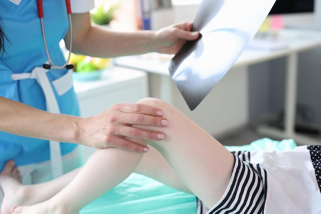 Medico della donna che tiene i raggi x ed esamina la gamba del bambino