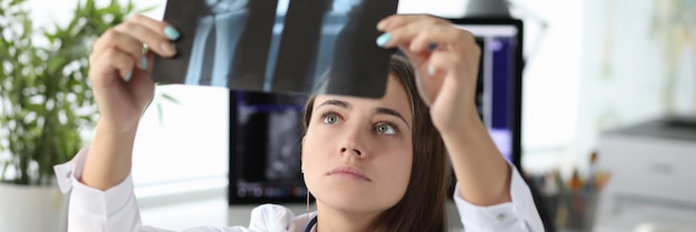 Woman doctor looking at xray of hand in clinic office