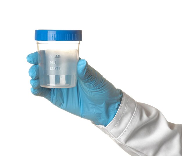 Woman doctor's hand is holding a jar for tests on a white isolated background hand gestures