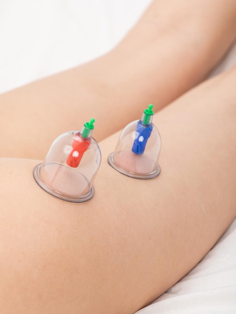 Woman getting anticellulite massage of buttock and legs with use of vacuum cans on white background