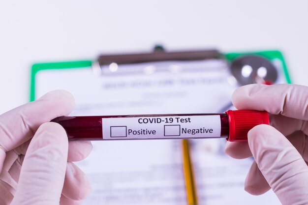 Woman hand holding the test tube with blood sample for COVID-19 test. Covid-19 breakout concept.