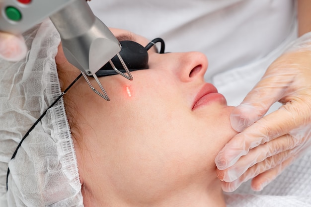 Woman hands do laser rejuvenation procedure on woman face wearing protective glasses, close up