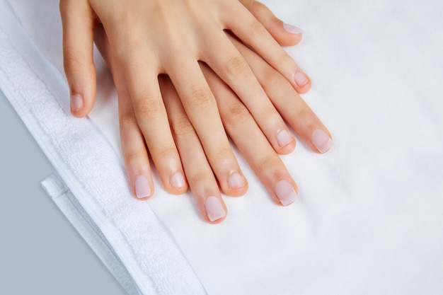 woman hands with nails before treatment