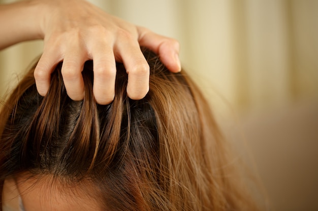 Una donna ha problemi con i capelli e il cuoio capelluto, ha la forfora da reazioni allergiche agli shampoo. e balsamo per capelli