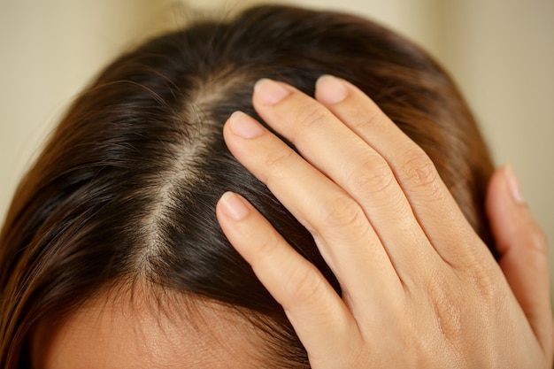 Una donna ha problemi con i capelli e il cuoio capelluto