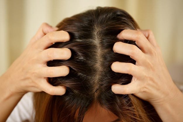 Photo a woman has problems with hair and scalpshe has dandruff