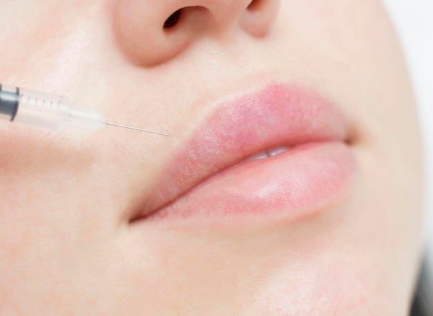 입술 모양을 증가시키기 위해 여자 입 주사 근처에 절차 입술 확대술을 하는 여성