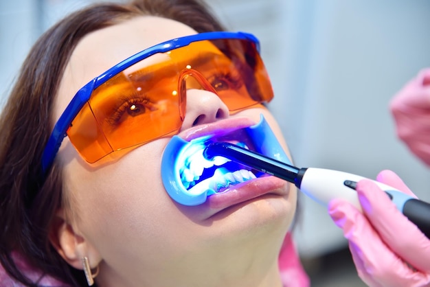 Woman having teeth whitened by dental UV whitening device