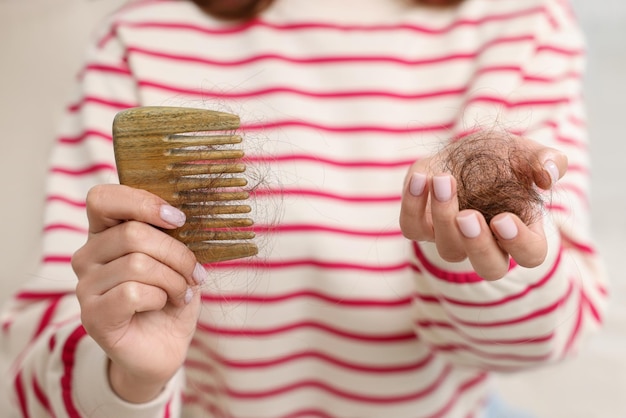 Woman holding comb with lost hair closeup Alopecia problem