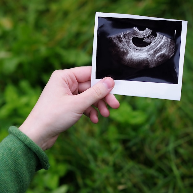 Woman holding ultrasound photographs of pregnancy