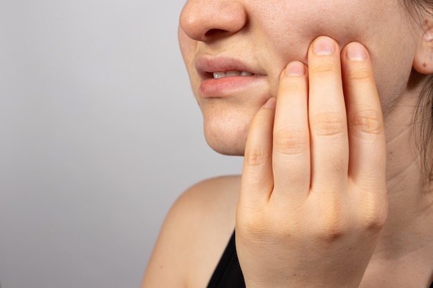 A woman holds her cheek with an aching tooth with her hand.