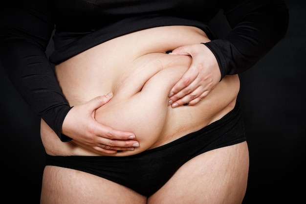 A woman holds her hands on a fat belly on a black background obese person