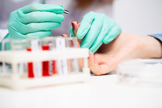 Photo woman at the hospital submits a blood test for a coronavirus