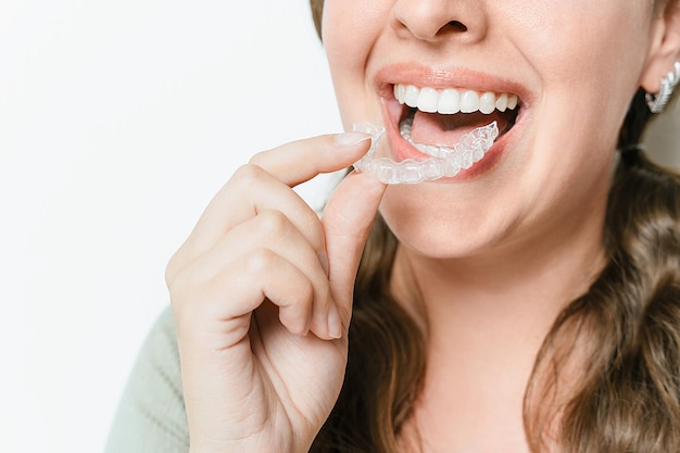 woman inserting clear teeth aligner