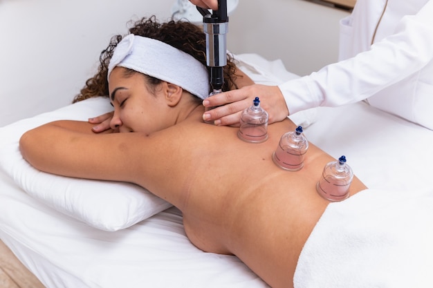 Woman lying on her chest with cupping treatment on her back. woman doing sucker