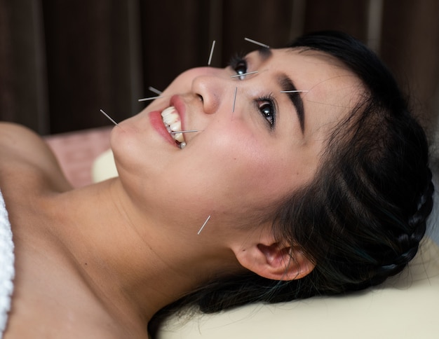 Woman lying on a table in an alternative medicine spa having an acupuncture and reiki treatment done on her face by an acupucturist