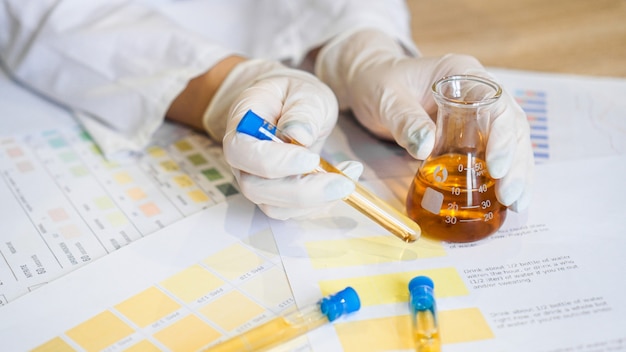 Woman making urine test with ph material in laboratory. Female hands in gloves and a flask of urine in the medical office