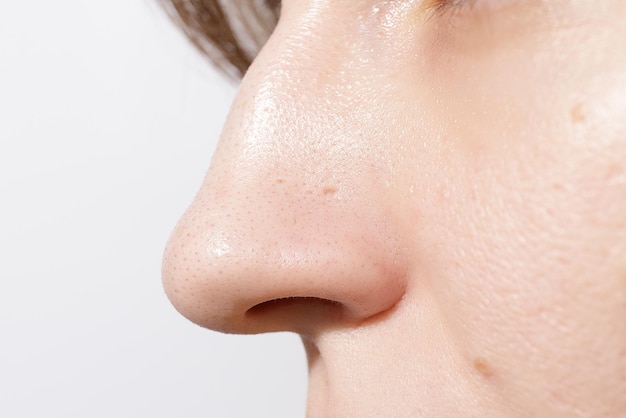 A woman nose with blackheads or black dots acne problem comedones enlarged pores on the face