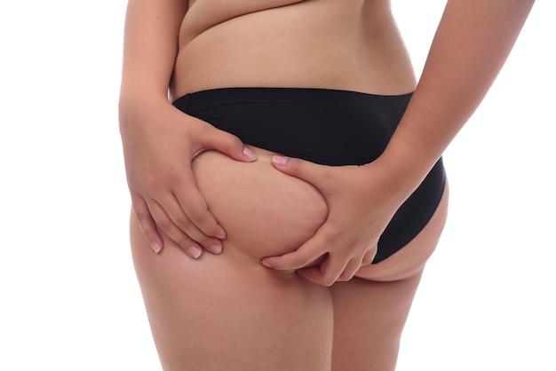 woman pinched her fat on body