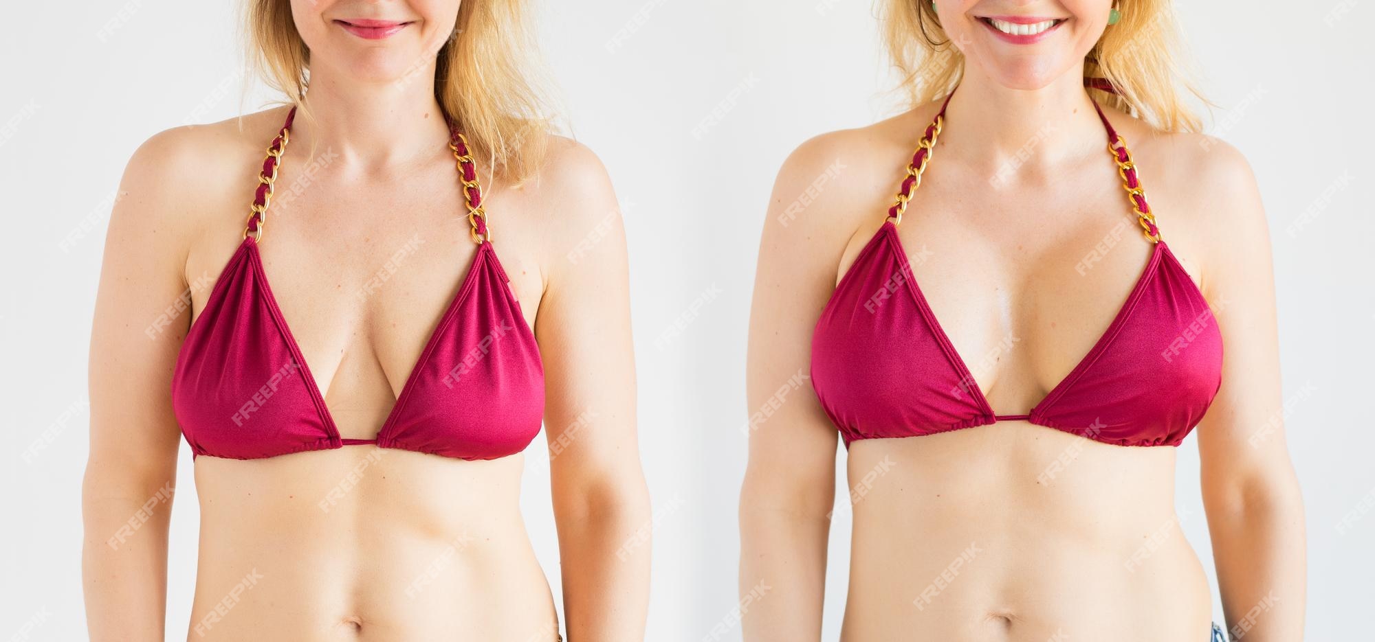 Premium Photo Woman Posing Before And After Breast Augmentation Plastic Surgery With Silicone