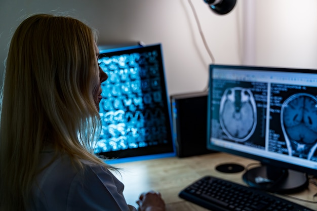 X線をオンにしてモニターを見ている女性の放射線科医。脳神経外科の概念。