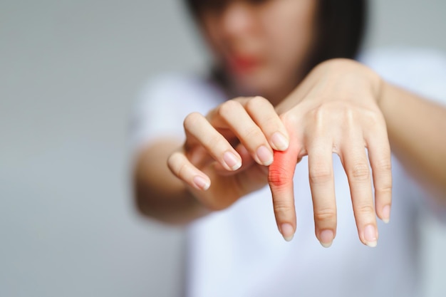 Mano della donna con dolori articolari concetto di assistenza sanitaria