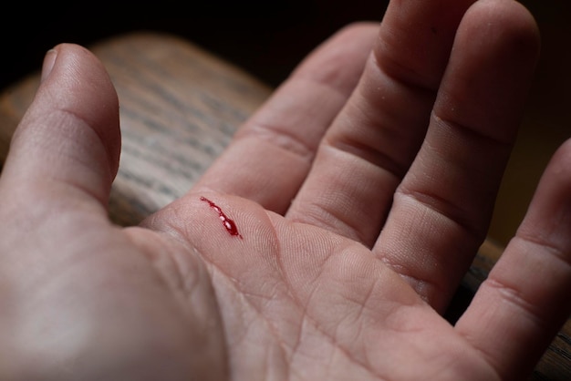 Woman's hand with knife wound