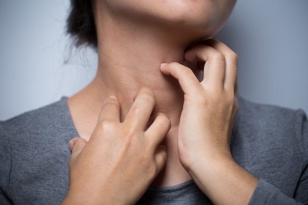 Woman scratching her neck