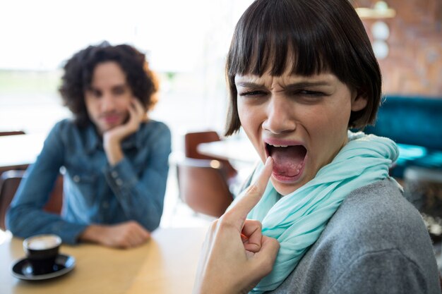 Woman showing burned tongue