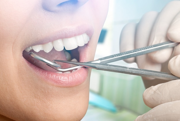 Woman teeth and a dentist mouth mirror on background