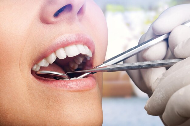 Woman teeth and a dentist mouth mirror on background