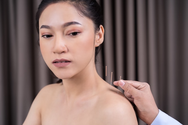 Woman undergoing acupuncture treatment on shoulder