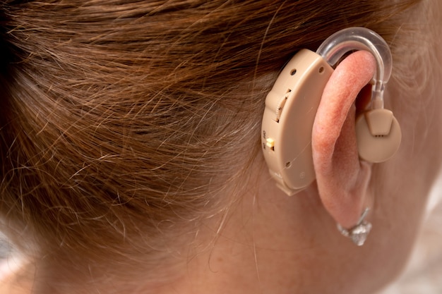 Woman wearing Modern digital hearing aid