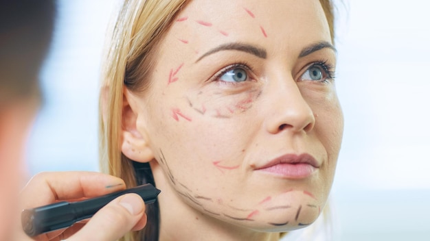 A woman with acupuncture marks on her face