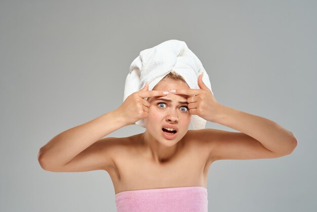 Woman with bare shoulders and a towel on her head pimples on\
her face closeup