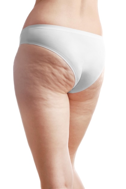 Woman with cellulite on buttocks and legs against white background