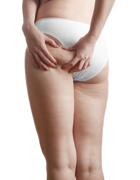 woman with cellulite on buttocks and legs against white background