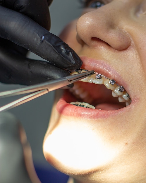 A woman with dental braces visits an orthodontist in the clinic in a dental chair