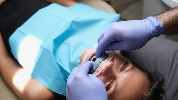 Donna con impiallacciatura dentale fusa sulla mascella superiore in odontoiatria