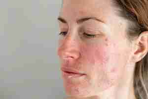 Photo a woman with freckles on her face and a white background