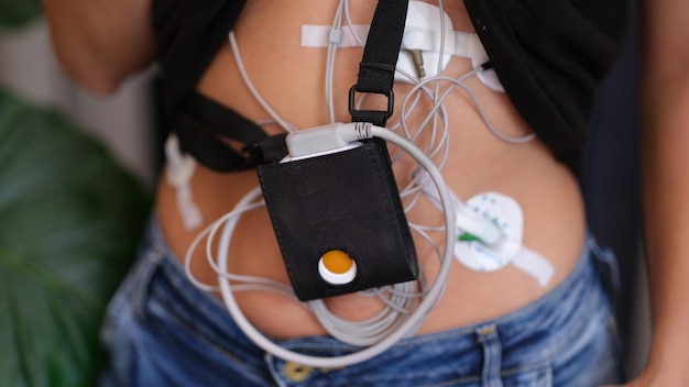 Foto donna con monitor holter per il monitoraggio quotidiano dell'elettrocardiogramma e della pressione sanguigna