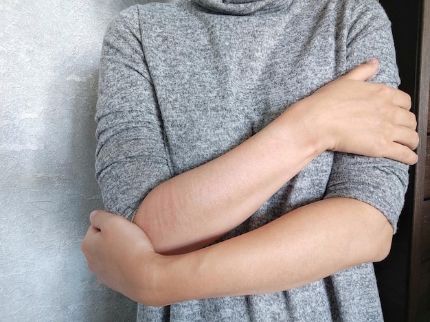 Woman with injuries after selfharm wraps her arms around herself autoaggression mental health