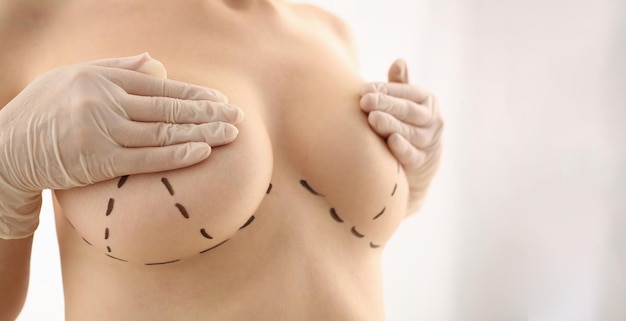 Photo woman with marks on chest for breast augmentation