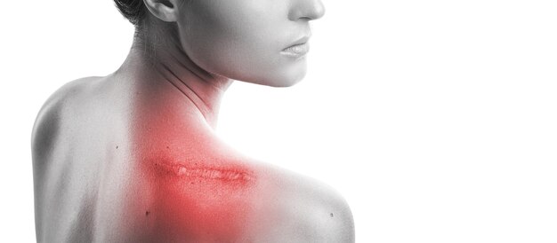 Woman with a scar on her shoulder over white background