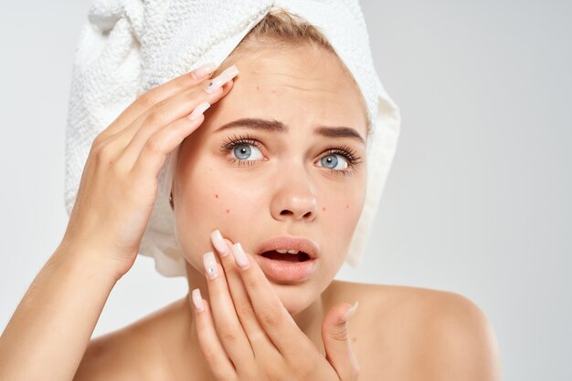 Woman with towel on head health clean skin point on face