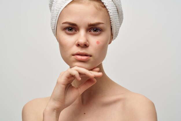 Woman with towel on head naked shoulders clear skin acne spa\
treatments